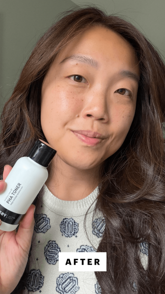 Allure contributing commerce writer Christa Joanna Lee after applying The Inkey List PHA Toner